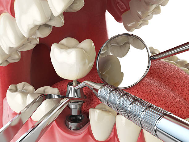 Best Emergency Cosmetic Dentistry (e.g., broken veneers) in Plummer, ID